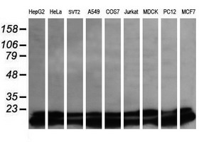 UBE2G2 Antibody - Western blot of extracts (35ug) from 9 different cell lines by using anti-UBE2G2 monoclonal antibody (HepG2: human; HeLa: human; SVT2: mouse; A549: human; COS7: monkey; Jurkat: human; MDCK: canine; PC12: rat; MCF7: human).