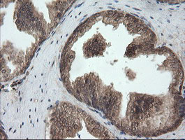 UBE2G2 Antibody - IHC of paraffin-embedded Human prostate tissue using anti-UBE2G2 mouse monoclonal antibody.