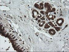 UBE2G2 Antibody - IHC of paraffin-embedded Human breast tissue using anti-UBE2G2 mouse monoclonal antibody.