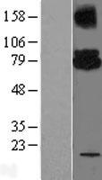 UBE2G2 Protein - Western validation with an anti-DDK antibody * L: Control HEK293 lysate R: Over-expression lysate