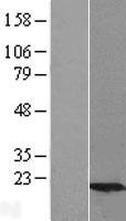 UBE2G2 Protein - Western validation with an anti-DDK antibody * L: Control HEK293 lysate R: Over-expression lysate