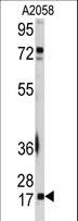 UBE2I / UBC9 Antibody - Western blot of anti-UBE2I Antibody in A2058 cell line lysates (35 ug/lane). UBE2I(arrow) was detected using the purified antibody.