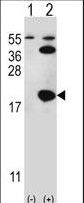 UBE2I / UBC9 Antibody - Western blot of UBE2I (arrow) using rabbit polyclonal UBE2I Antibody (S7). 293 cell lysates (2 ug/lane) either nontransfected (Lane 1) or transiently transfected (Lane 2) with the UBE2I gene.