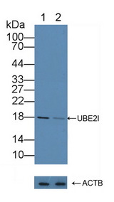 UBE2I / UBC9 Antibody - Knockout Varification: Lane 1: Wild-type Hela cell lysate; Lane 2: UBE2I knockout Hela cell lysate; Predicted MW: 18kd Observed MW: 18kd Primary Ab: 2µg/ml Rabbit Anti-Human UBE2I Antibody Second Ab: 0.2µg/mL HRP-Linked Caprine Anti-Rabbit IgG Polyclonal Antibody