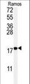 UBE2I / UBC9 Antibody - Western blot of anti-UBC9 Antibody in Ramos cell line lysates (35 ug/lane). UBC9(arrow) was detected using the purified antibody.