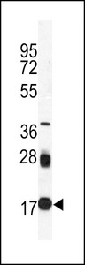 UBE2I / UBC9 Antibody - Western blot of anti-UBC9 Antibody in mouse spleen tissue lysates (35 ug/lane). UBC9(arrow) was detected using the purified antibody.