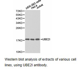UBE2I / UBC9 Antibody - Western blot.