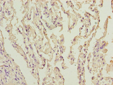 UBE2I / UBC9 Antibody - Immunohistochemistry of paraffin-embedded human prostate tissue using UBE2I Antibody at dilution of 1:50