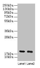 UBE2I / UBC9 Antibody - Western blot All lanes: SUMO-conjµgating enzyme UBC9 antibody at 2µg/ml Lane 1: 293T whole cell lysate Lane 2: EC109 whole cell lysate Secondary Goat polyclonal to rabbit IgG at 1/15000 dilution Predicted band size: 17.4 kDa Observed band size: 17.4 kDa