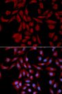 UBE2I / UBC9 Antibody - Immunofluorescence analysis of U2OS cells using UBE2I antibody. Blue: DAPI for nuclear staining.