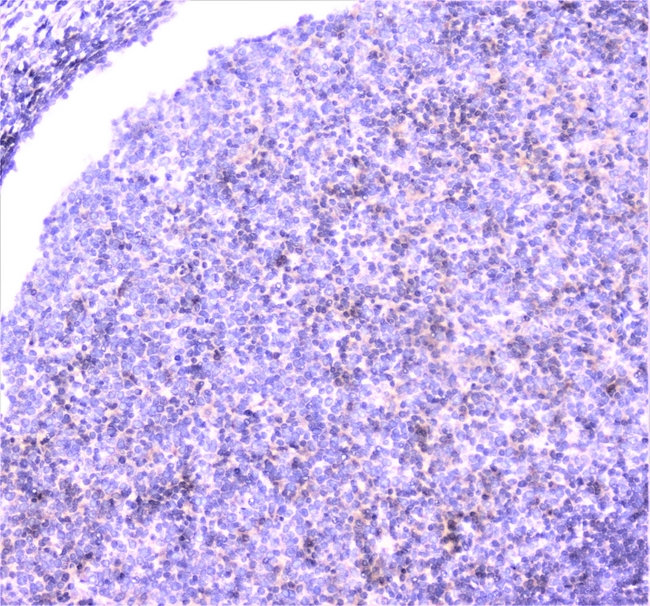 UBE2I / UBC9 Antibody - IHC analysis of UBE2I/UBC9 using anti-UBE2I/UBC9 antibody. UBE2I/UBC9 was detected in paraffin-embedded section of human tonsil tissue. Heat mediated antigen retrieval was performed in citrate buffer (pH6, epitope retrieval solution) for 20 mins. The tissue section was blocked with 10% goat serum. The tissue section was then incubated with 1µg/ml rabbit anti-UBE2I/UBC9 Antibody overnight at 4°C. Biotinylated goat anti-rabbit IgG was used as secondary antibody and incubated for 30 minutes at 37°C. The tissue section was developed using Strepavidin-Biotin-Complex (SABC) with DAB as the chromogen.