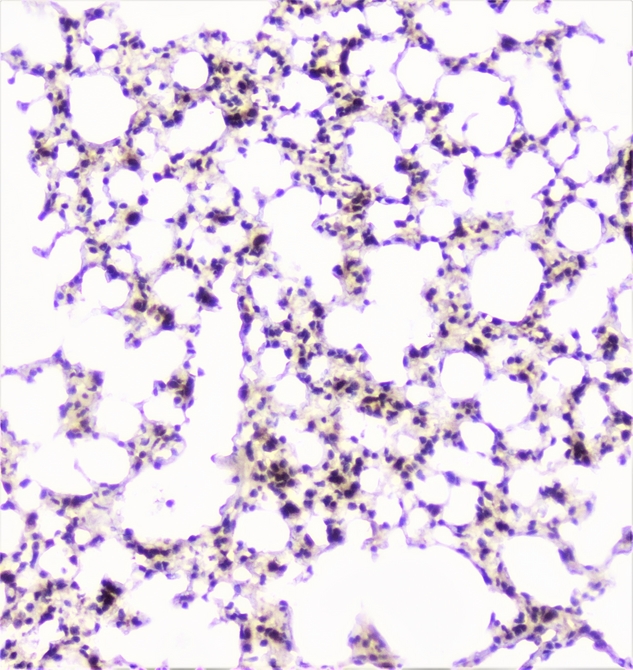 UBE2I / UBC9 Antibody - IHC analysis of UBE2I/UBC9 using anti-UBE2I/UBC9 antibody. UBE2I/UBC9 was detected in paraffin-embedded section of mouse lung tissue. Heat mediated antigen retrieval was performed in citrate buffer (pH6, epitope retrieval solution) for 20 mins. The tissue section was blocked with 10% goat serum. The tissue section was then incubated with 1µg/ml rabbit anti-UBE2I/UBC9 Antibody overnight at 4°C. Biotinylated goat anti-rabbit IgG was used as secondary antibody and incubated for 30 minutes at 37°C. The tissue section was developed using Strepavidin-Biotin-Complex (SABC) with DAB as the chromogen.