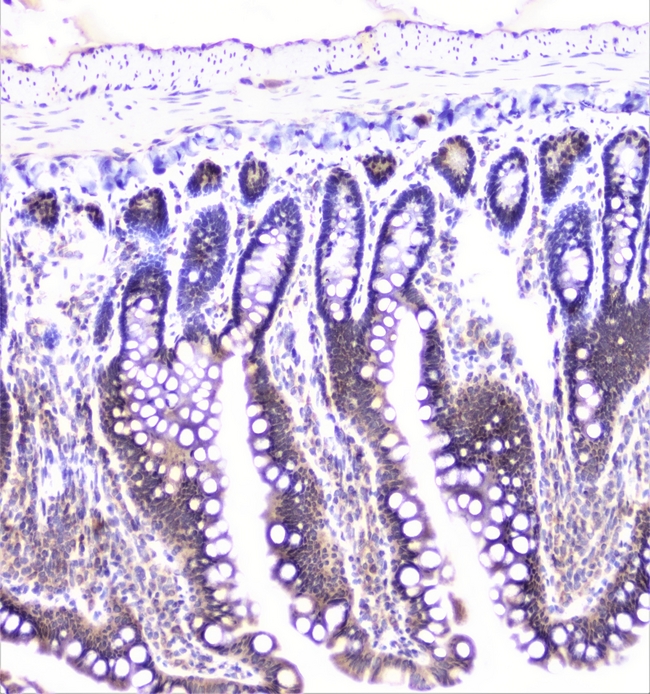 UBE2I / UBC9 Antibody - IHC analysis of UBE2I/UBC9 using anti-UBE2I/UBC9 antibody. UBE2I/UBC9 was detected in paraffin-embedded section of rat intestine tissue. Heat mediated antigen retrieval was performed in citrate buffer (pH6, epitope retrieval solution) for 20 mins. The tissue section was blocked with 10% goat serum. The tissue section was then incubated with 1µg/ml rabbit anti-UBE2I/UBC9 Antibody overnight at 4°C. Biotinylated goat anti-rabbit IgG was used as secondary antibody and incubated for 30 minutes at 37°C. The tissue section was developed using Strepavidin-Biotin-Complex (SABC) with DAB as the chromogen.
