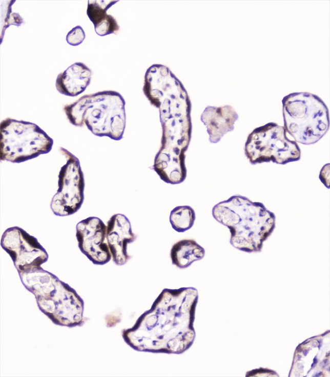 UBE2I / UBC9 Antibody - IHC analysis of UBE2I UBC9 using anti-UBE2I UBC9 antibody. UBE2I UBC9 was detected in paraffin-embedded section of human placenta tissue. Heat mediated antigen retrieval was performed in citrate buffer (pH6, epitope retrieval solution) for 20 mins. The tissue section was blocked with 10% goat serum. The tissue section was then incubated with 1µg/ml rabbit anti-UBE2I UBC9 Antibody overnight at 4°C. Biotinylated goat anti-rabbit IgG was used as secondary antibody and incubated for 30 minutes at 37°C. The tissue section was developed using Strepavidin-Biotin-Complex (SABC) with DAB as the chromogen.