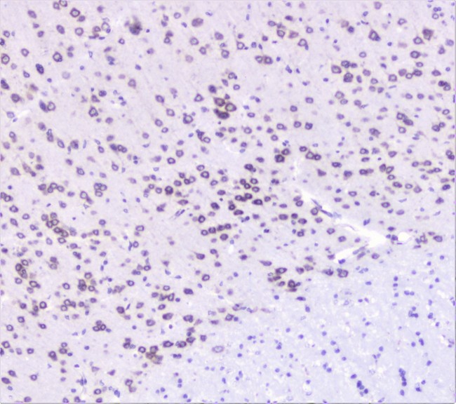 UBE2I / UBC9 Antibody - IHC analysis of UBE2I UBC9 using anti-UBE2I UBC9 antibody. UBE2I UBC9 was detected in paraffin-embedded section of mouse brain tissue. Heat mediated antigen retrieval was performed in citrate buffer (pH6, epitope retrieval solution) for 20 mins. The tissue section was blocked with 10% goat serum. The tissue section was then incubated with 1µg/ml rabbit anti-UBE2I UBC9 Antibody overnight at 4°C. Biotinylated goat anti-rabbit IgG was used as secondary antibody and incubated for 30 minutes at 37°C. The tissue section was developed using Strepavidin-Biotin-Complex (SABC) with DAB as the chromogen.