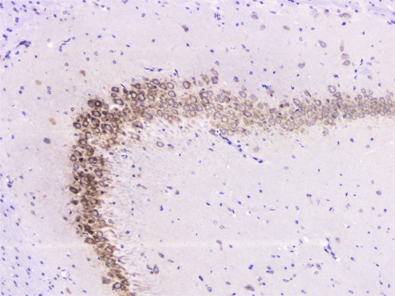 UBE2I / UBC9 Antibody - IHC analysis of UBE2I UBC9 using anti-UBE2I UBC9 antibody. UBE2I UBC9 was detected in paraffin-embedded section of rat brain tissue. Heat mediated antigen retrieval was performed in citrate buffer (pH6, epitope retrieval solution) for 20 mins. The tissue section was blocked with 10% goat serum. The tissue section was then incubated with 1µg/ml rabbit anti-UBE2I UBC9 Antibody overnight at 4°C. Biotinylated goat anti-rabbit IgG was used as secondary antibody and incubated for 30 minutes at 37°C. The tissue section was developed using Strepavidin-Biotin-Complex (SABC) with DAB as the chromogen.