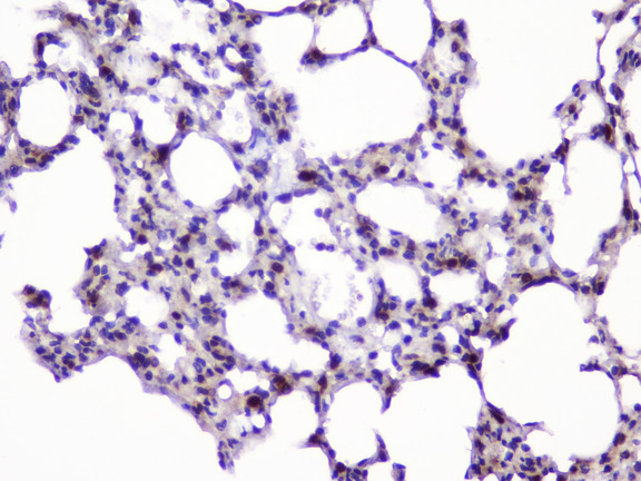 UBE2I / UBC9 Antibody - IHC analysis of UBE2I UBC9 using anti-UBE2I UBC9 antibody. UBE2I UBC9 was detected in paraffin-embedded section of rat lung tissue. Heat mediated antigen retrieval was performed in citrate buffer (pH6, epitope retrieval solution) for 20 mins. The tissue section was blocked with 10% goat serum. The tissue section was then incubated with 1µg/ml rabbit anti-UBE2I UBC9 Antibody overnight at 4°C. Biotinylated goat anti-rabbit IgG was used as secondary antibody and incubated for 30 minutes at 37°C. The tissue section was developed using Strepavidin-Biotin-Complex (SABC) with DAB as the chromogen.
