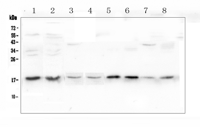 UBE2I / UBC9 Antibody - Western blot analysis of UBE2I UBC9 using anti-UBE2I UBC9 antibody. Electrophoresis was performed on a 5-20% SDS-PAGE gel at 70V (Stacking gel) / 90V (Resolving gel) for 2-3 hours. The sample well of each lane was loaded with 50ug of sample under reducing conditions. Lane 1: human K562 whole cell lysate,Lane 2: human HepG2 whole cell lysate,Lane 3: rat kidney tissue lysates,Lane 4: rat spleen tissue lysates,Lane 5: rat ovary tissue lysates,Lane 6: mouse spleen tissue lysates,Lane 7: mouse ovary tissue lysates,Lane 8: mouse liver tissue lysates. After Electrophoresis, proteins were transferred to a Nitrocellulose membrane at 150mA for 50-90 minutes. Blocked the membrane with 5% Non-fat Milk/ TBS for 1.5 hour at RT. The membrane was incubated with rabbit anti-UBE2I UBC9 antigen affinity purified polyclonal antibody at 0.5 µg/mL overnight at 4°C, then washed with TBS-0.1% Tween 3 times with 5 minutes each and probed with a goat anti-rabbit IgG-HRP secondary antibody at a dilution of 1:10000 for 1.5 hour at RT. The signal is developed using an Enhanced Chemiluminescent detection (ECL) kit with Tanon 5200 system. A specific band was detected for UBE2I UBC9 at approximately 18KD. The expected band size for UBE2I UBC9 is at 18KD.