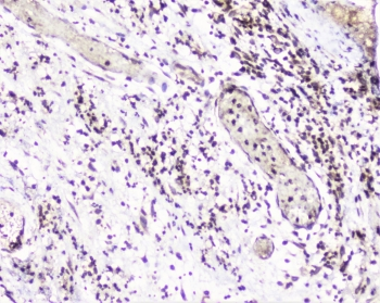 UBE2I / UBC9 Antibody - IHC staining of FFPE human appendicitis with UBC9 antibody at 1ug/ml. HIER: boil tissue sections in pH6, 10mM citrate buffer, for 10-20 min followed by cooling at RT for 20 min.