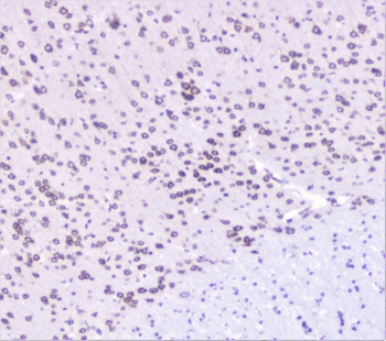 UBE2I / UBC9 Antibody - IHC staining of FFPE mouse brain with UBC9 antibody at 1ug/ml. HIER: boil tissue sections in pH6, 10mM citrate buffer, for 10-20 min followed by cooling at RT for 20 min.