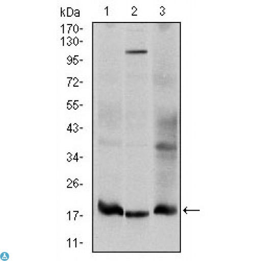 UBE2I / UBC9 Antibody - Western Blot (WB) analysis using UBC9 Monoclonal Antibody against HeLa (1), HepG2 (2), and Cos7 (3) cell lysate.