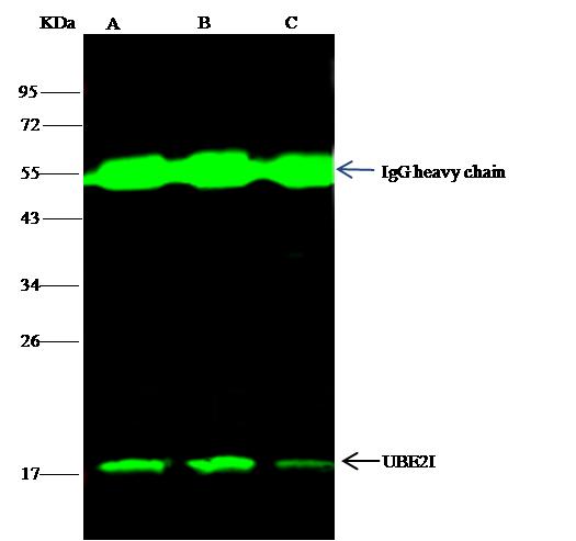 UBE2I / UBC9 Antibody - UBE2I was immunoprecipitated using: Lane A: 0.5 mg Jurkat Whole Cell Lysate. Lane B: 0.5 mg Hela Whole Cell Lysate. Lane C:0.5 mg A431 Whole Cell Lysate. 2 uL anti-UBE2I rabbit polyclonal antibody and 15 ul of 50% Protein G agarose. Primary antibody: Anti-UBE2I rabbit polyclonal antibody, at 1:100 dilution. Secondary antibody: Dylight 800-labeled antibody to rabbit IgG (H+L), at 1:5000 dilution. Developed using the odssey technique. Performed under reducing conditions. Predicted band size: 18 kDa. Observed band size: 18 kDa.