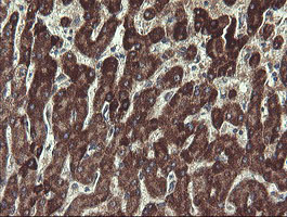 UBE2J1 Antibody - IHC of paraffin-embedded Human liver tissue using anti-UBE2J1 mouse monoclonal antibody.