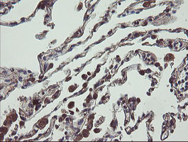 UBE2J1 Antibody - IHC of paraffin-embedded Human lung tissue using anti-UBE2J1 mouse monoclonal antibody.