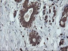 UBE2J1 Antibody - IHC of paraffin-embedded Human breast tissue using anti-UBE2J1 mouse monoclonal antibody.