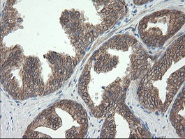 UBE2J1 Antibody - IHC of paraffin-embedded Human prostate tissue using anti-UBE2J1 mouse monoclonal antibody.