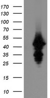UBE2J1 Antibody - HEK293T cells were transfected with the pCMV6-ENTRY control (Left lane) or pCMV6-ENTRY UBE2J1 (Right lane) cDNA for 48 hrs and lysed. Equivalent amounts of cell lysates (5 ug per lane) were separated by SDS-PAGE and immunoblotted with anti-UBE2J1.