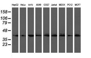 UBE2J1 Antibody - Western blot of extracts (35 ug) from 9 different cell lines by using g anti-UBE2J1 monoclonal antibody (HepG2: human; HeLa: human; SVT2: mouse; A549: human; COS7: monkey; Jurkat: human; MDCK: canine; PC12: rat; MCF7: human).