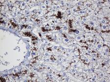UBE2J1 Antibody - IHC of paraffin-embedded Human liver tissue using anti-UBE2J1 mouse monoclonal antibody. (Heat-induced epitope retrieval by 10mM citric buffer, pH6.0, 120°C for 3min).