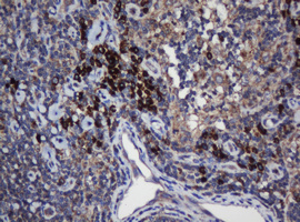 UBE2J1 Antibody - IHC of paraffin-embedded Human lymph node tissue using anti-UBE2J1 mouse monoclonal antibody. (Heat-induced epitope retrieval by 10mM citric buffer, pH6.0, 120°C for 3min).