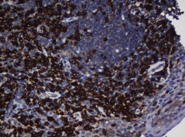 UBE2J1 Antibody - IHC of paraffin-embedded Human tonsil using anti-UBE2J1 mouse monoclonal antibody. (Heat-induced epitope retrieval by 10mM citric buffer, pH6.0, 120°C for 3min).