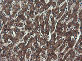 UBE2J1 Antibody - IHC of paraffin-embedded Human liver tissue using anti-UBE2J1 mouse monoclonal antibody.