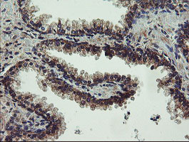 UBE2J1 Antibody - IHC of paraffin-embedded Human prostate tissue using anti-UBE2J1 mouse monoclonal antibody.