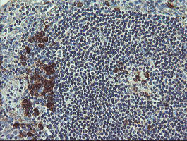 UBE2J1 Antibody - IHC of paraffin-embedded Human tonsil using anti-UBE2J1 mouse monoclonal antibody.