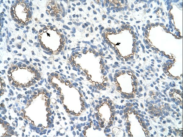 UBE2J1 Antibody - UBE2J1 antibody ARP43206_T100-NP_057105-UBE2J1(ubiquitin-conjugating enzyme E2, J1 (UBC6 homolog, yeast)) Antibody was used in IHC to stain formalin-fixed, paraffin-embedded human lung.  This image was taken for the unconjugated form of this product. Other forms have not been tested.