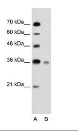 UBE2J1 Antibody - A: Marker, B: Jurkat Cell Lysate.  This image was taken for the unconjugated form of this product. Other forms have not been tested.