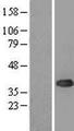 UBE2J1 Protein - Western validation with an anti-DDK antibody * L: Control HEK293 lysate R: Over-expression lysate