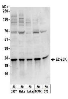 UBE2K / LIG Antibody - Detection of Human and Mouse E2-25K by Western Blot. Samples: Whole cell lysate (50 ug) from 293T, HeLa, Jurkat, mouse TCMK-1, and mouse NIH3T3 cells. Antibodies: Affinity purified rabbit anti-E2-25K antibody used for WB at 0.4 ug/ml. Detection: Chemiluminescence with an exposure time of 10 seconds.