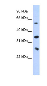 UBE2K / LIG Antibody - UBE2K / HIP2 antibody Western blot of Transfected 293T cell lysate.  This image was taken for the unconjugated form of this product. Other forms have not been tested.