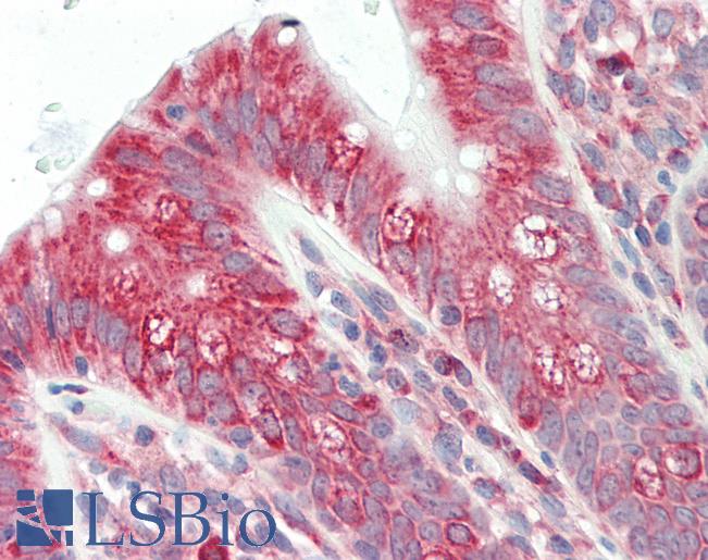 UBE2K / LIG Antibody - Anti-UBE2K / LIG antibody IHC staining of human colon. Immunohistochemistry of formalin-fixed, paraffin-embedded tissue after heat-induced antigen retrieval. Antibody concentration 5 ug/ml.  This image was taken for the unconjugated form of this product. Other forms have not been tested.