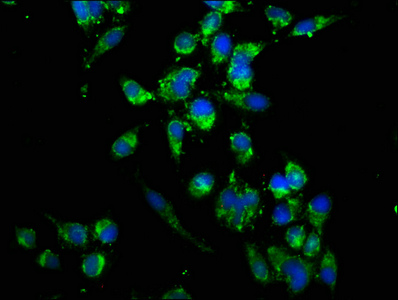 UBE2K / LIG Antibody - Immunofluorescence staining of Hela cells with UBE2K Antibody at 1:166, counter-stained with DAPI. The cells were fixed in 4% formaldehyde, permeabilized using 0.2% Triton X-100 and blocked in 10% normal Goat Serum. The cells were then incubated with the antibody overnight at 4°C. The secondary antibody was Alexa Fluor 488-congugated AffiniPure Goat Anti-Rabbit IgG(H+L).