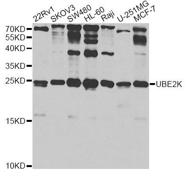 UBE2K / LIG Antibody - Western blot analysis of extracts of various cell lines, using UBE2K antibody at 1:1000 dilution. The secondary antibody used was an HRP Goat Anti-Rabbit IgG (H+L) at 1:10000 dilution. Lysates were loaded 25ug per lane and 3% nonfat dry milk in TBST was used for blocking. An ECL Kit was used for detection and the exposure time was 30s.