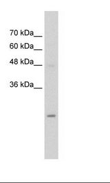 UBE2K / LIG Antibody - Jurkat Cell Lysate.  This image was taken for the unconjugated form of this product. Other forms have not been tested.