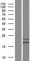 UBE2K / LIG Protein - Western validation with an anti-DDK antibody * L: Control HEK293 lysate R: Over-expression lysate