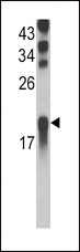 UBE2L3 / UBCH7 Antibody - Western blot of UBE2L3 Antibody in Ramos cell line lysates (35 ug/lane). UBE2L3 (arrow) was detected using the purified antibody.