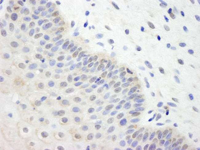 UBE2L3 / UBCH7 Antibody - Detection of Human UBCH7 by Immunohistochemistry. Sample: FFPE section of human cervix. Antibody: Affinity purified rabbit anti-UBCH7 used at a dilution of 1:500.